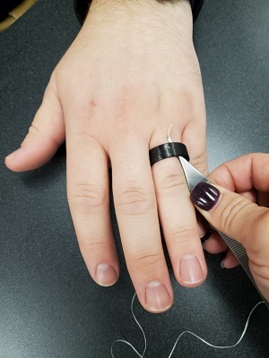 How to Safely Remove a Ring from a Swollen Finger